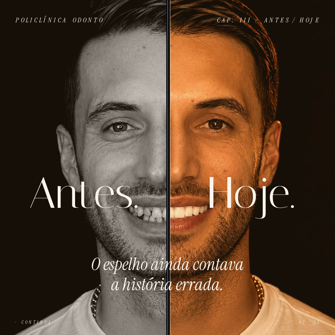 Depois 2